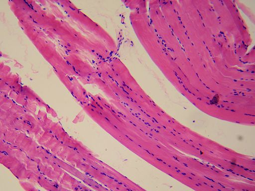 muscle tissue