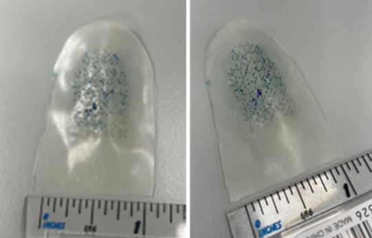 sample of Xobaflex System 