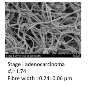 Clot Microstructure