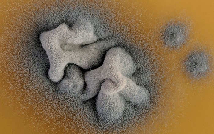 An image of Aspergillus fumigatus colonies on an agar plate. Invasive aspergillosis is a devastating disease cause by breathing in its airborne spores and is a condition where drug resistance has been encountered.