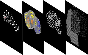 Researchers develop new method to map cholesterol metabolism in brain