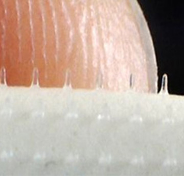 Microneedle