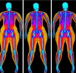 Body scans